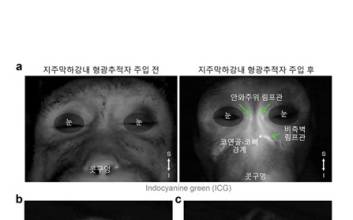 국내 연구진, '뇌 노폐물' 배출 늘리는 법 찾았다…치매 적용 기대