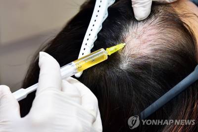 탈모는 생존문제?…정부 "청년 탈모, 건보 지원 확정된 바 없다"