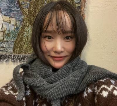 '헤이지니'도 모발이식 받았다…"두꺼운 헬멧 쓴 느낌" 결과는?